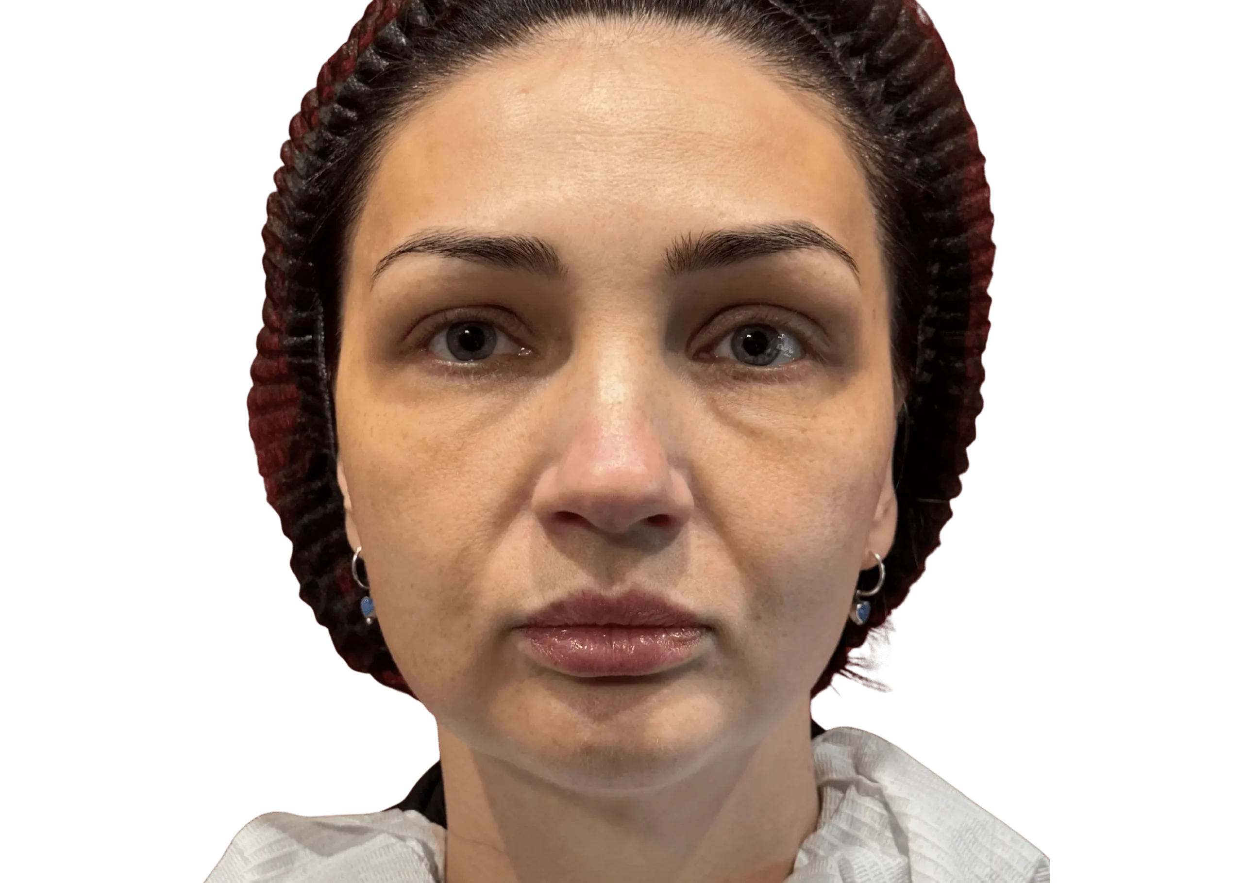 Фото до